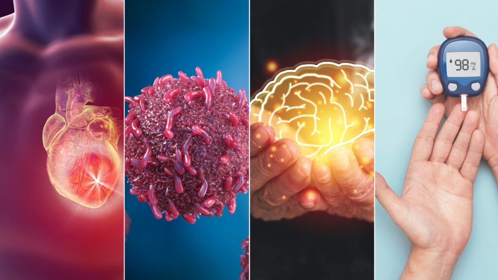 Medicine 3.0 targets the four major causes of chronic disease before symptoms appear
