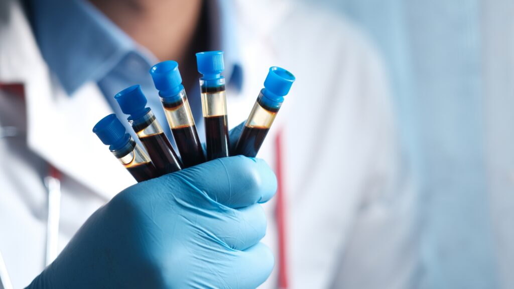 Comprehensive screening catches health problems in the early detection window, years before standard testing