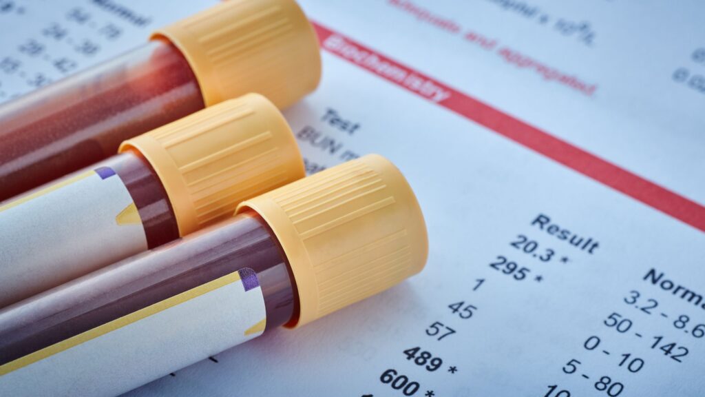 Comprehensive blood work after 40 tests metabolic health, cardiovascular risk, hormones, inflammation, and nutrient status